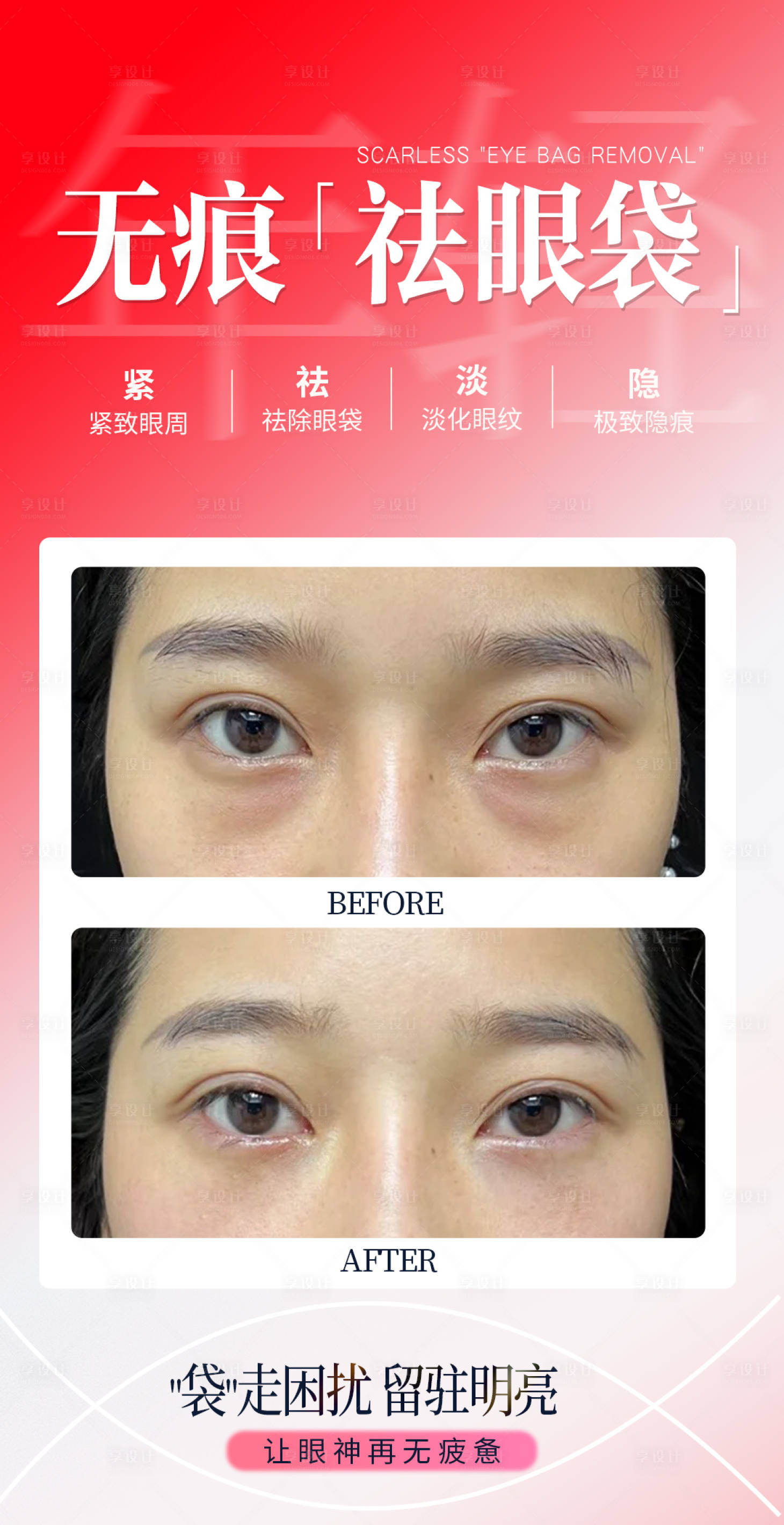 源文件下载【享设计】搜索编号：68010034916544863【无痕祛眼袋】