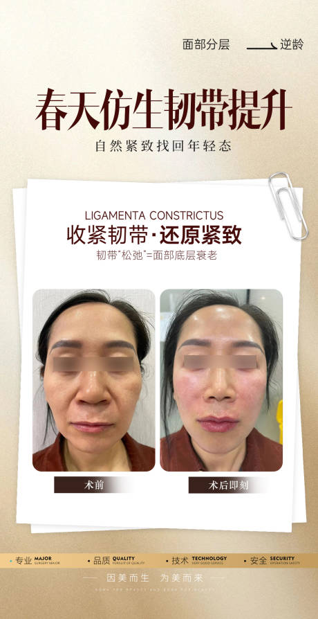 源文件下载【享设计】搜索编号：34510034807075654【韧带提升】