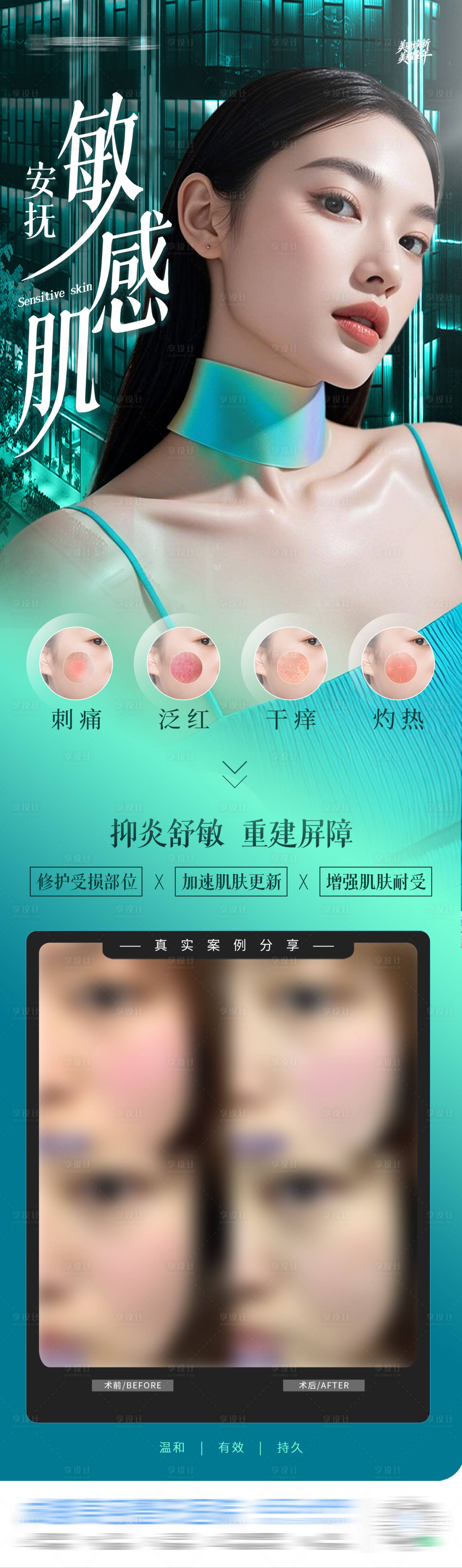 源文件下载【享设计】搜索编号：56520034924407026【医美敏感肌屏障修复案例对比创意海报】