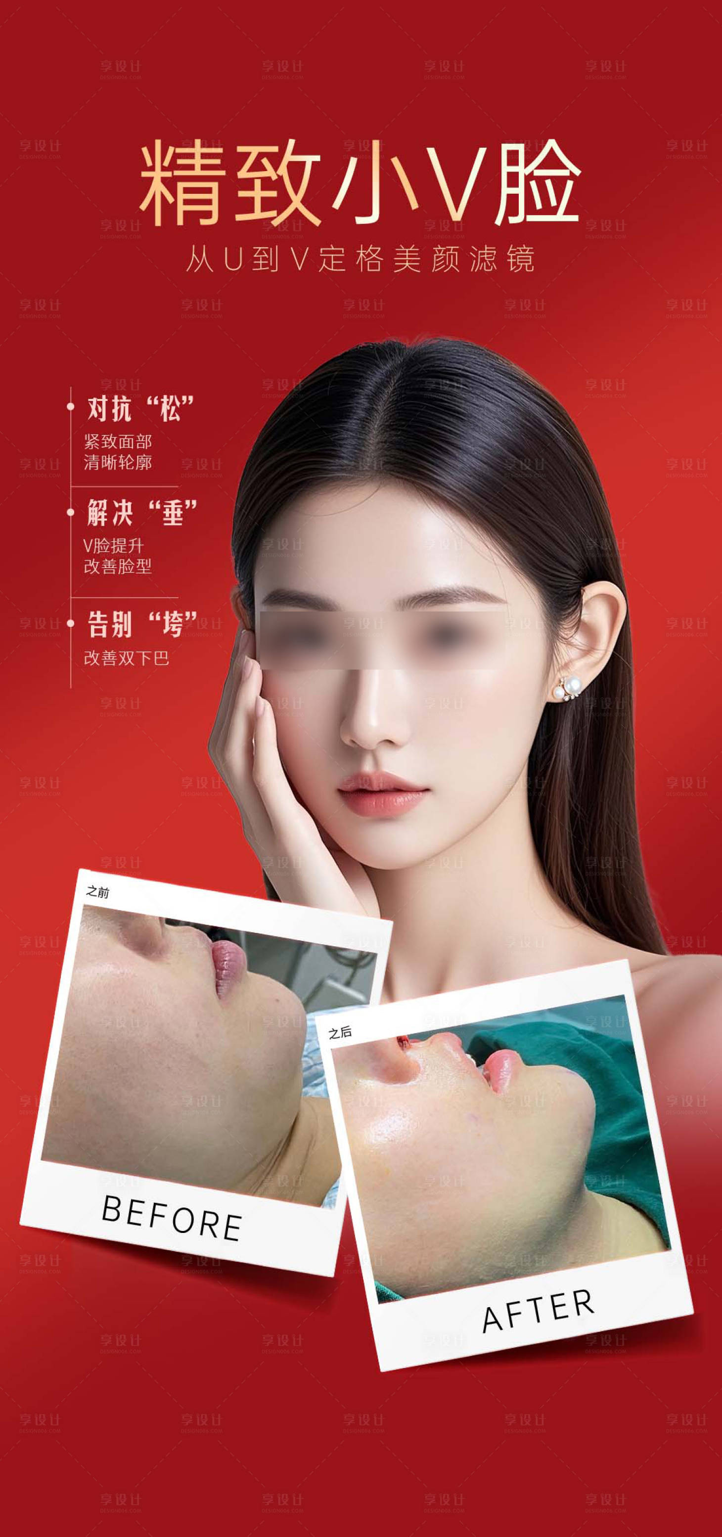 源文件下载【享设计】搜索编号：22120035276996522【医美案例海报】