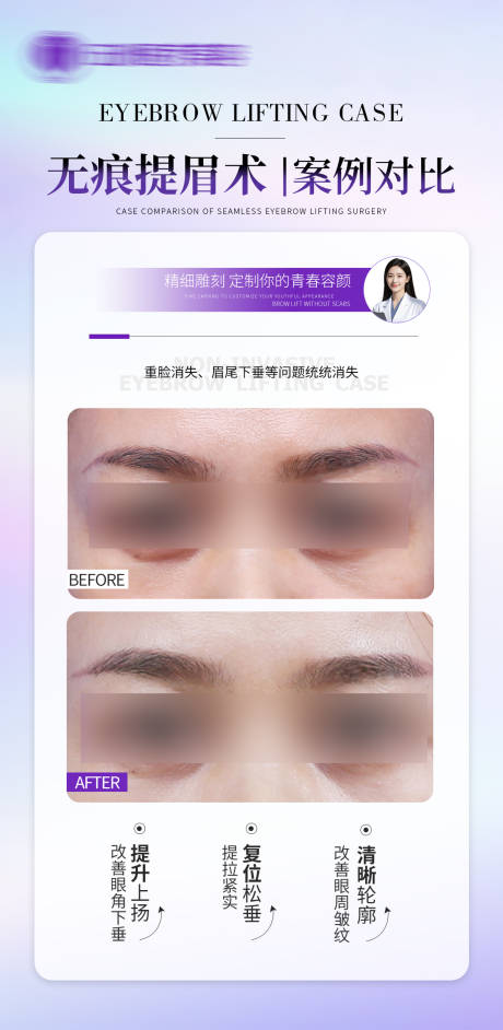 源文件下载【享设计】搜索编号：95430035052499690【医美无痕提眉】