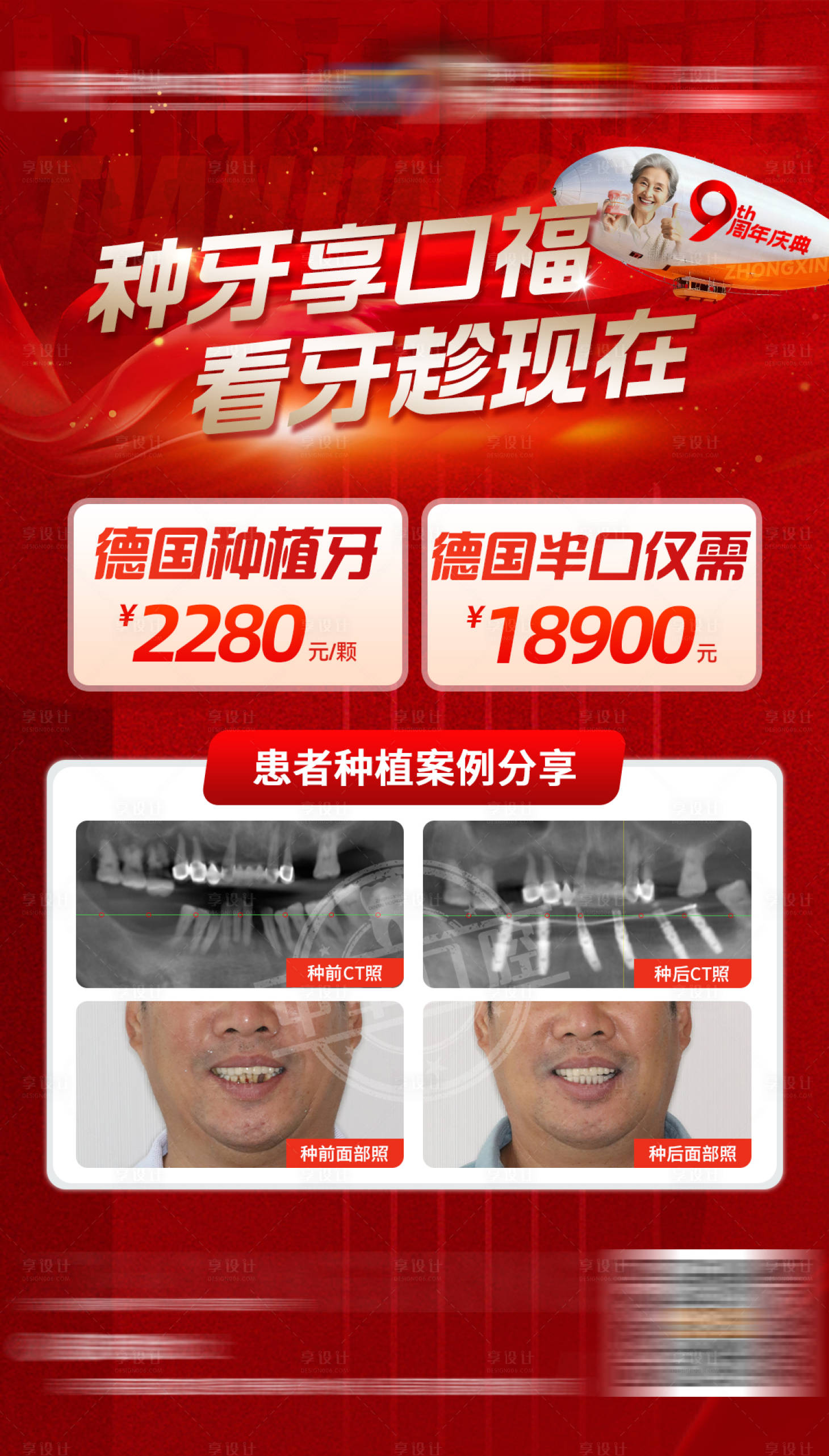 源文件下载【享设计】搜索编号：44290035284655335【口腔周年庆活动红金海报】