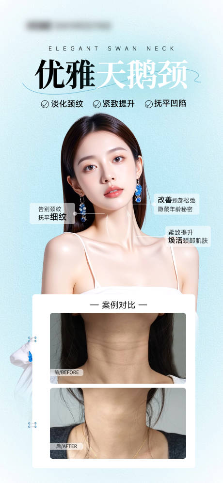 源文件下载【享设计】搜索编号：45760035420154862【医美天鹅颈海报案例】