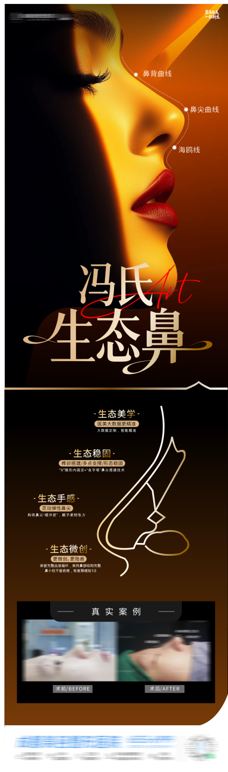 源文件下载【享设计】搜索编号：52440035512948300【医美隆鼻整形海报】