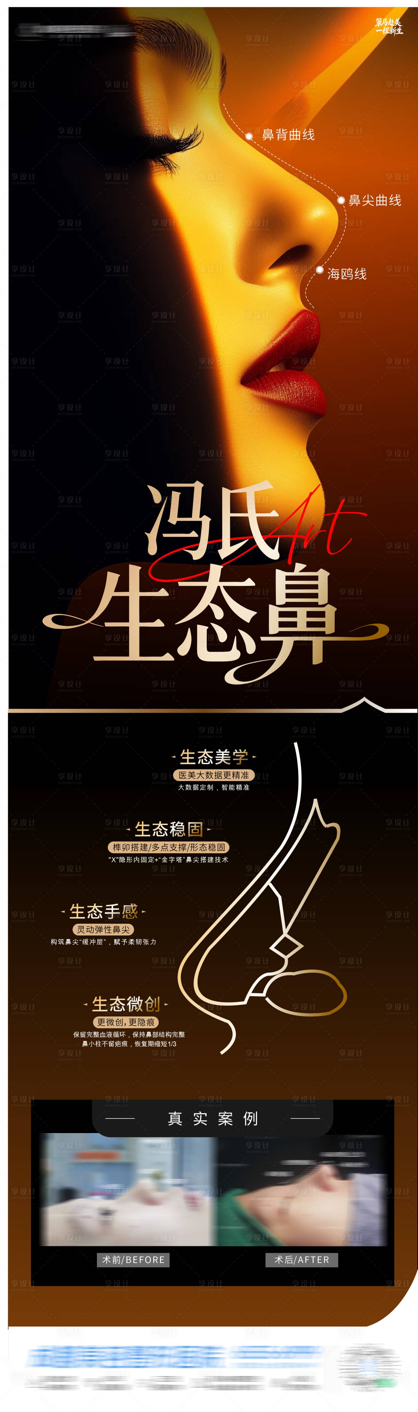 源文件下载【享设计】搜索编号：52440035512948300【医美隆鼻整形海报】