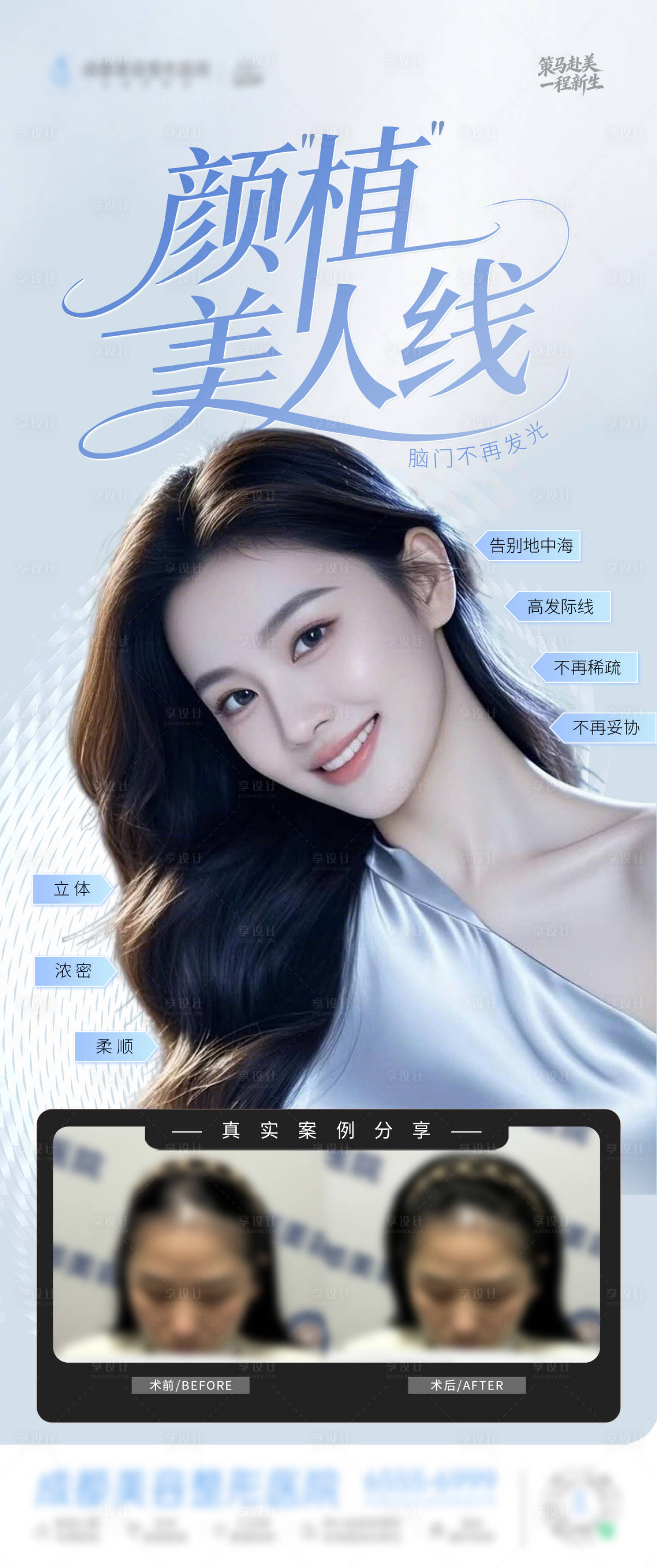 源文件下载【享设计】搜索编号：90340035545518254【医美美业微创植发案例创意海报】