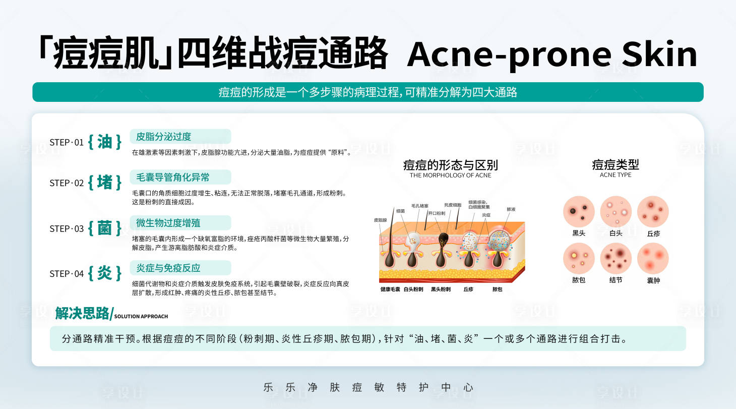 源文件下载【享设计】搜索编号：87250035413397636【痘痘肌四维战痘通路科普海报灯箱】