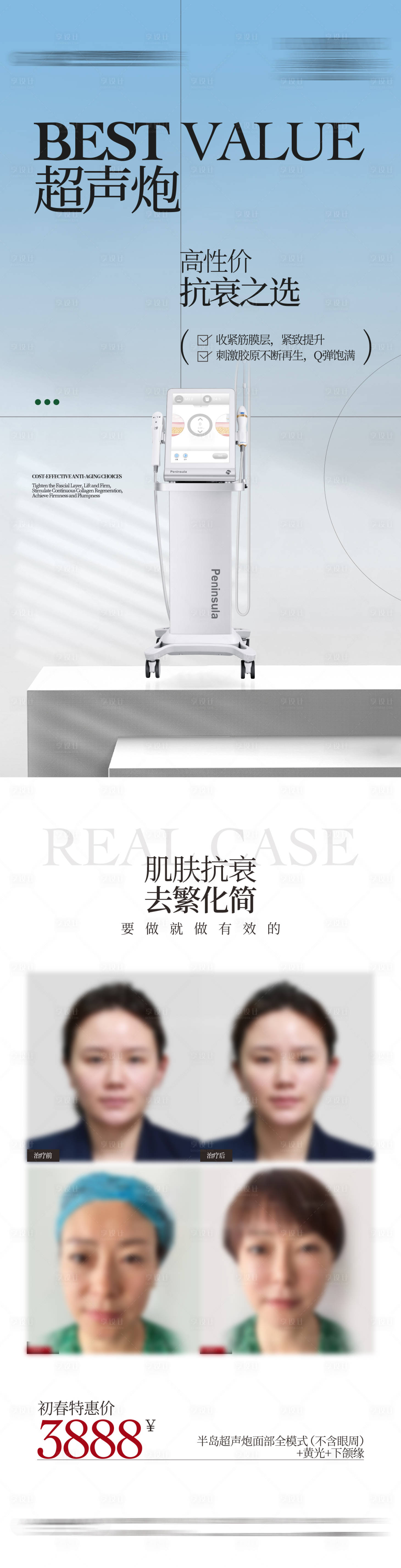 源文件下载【享设计】搜索编号：54590035566126503【仪器宣发朋友圈海报】