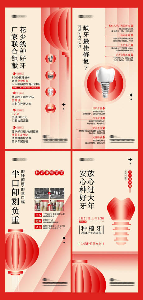 源文件下载【享设计】搜索编号：52830035347733159【种植牙活动手术观摩会】