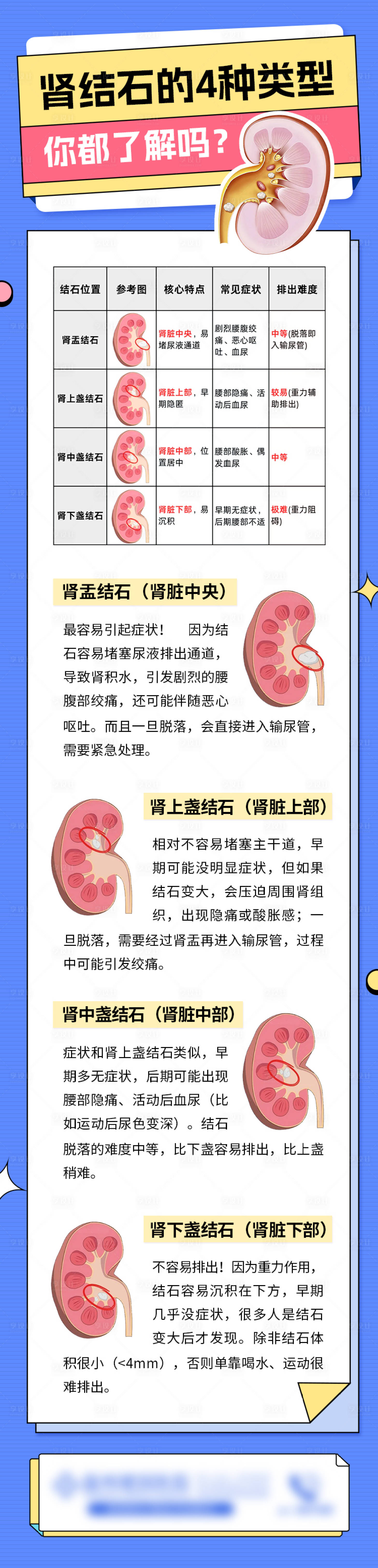 源文件下载【享设计】搜索编号：13420035522054489【肾结石科普】