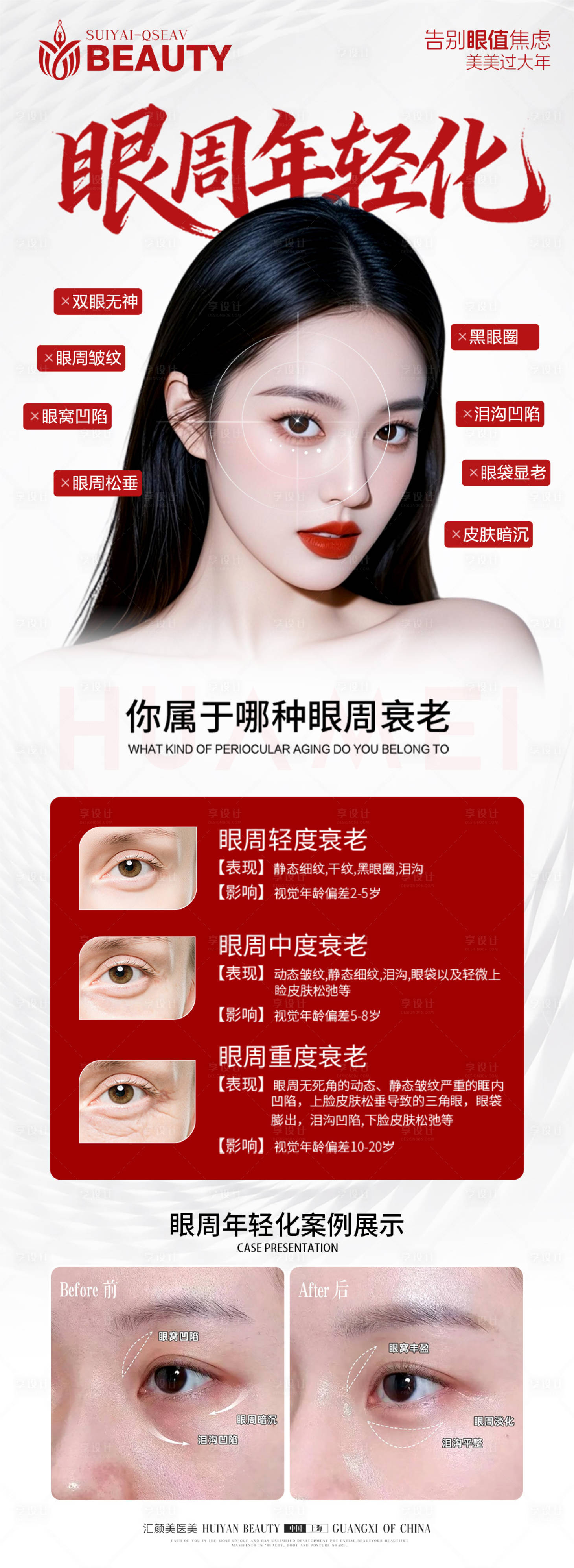 源文件下载【享设计】搜索编号：84450035314905673【眼周年轻化科普海报】