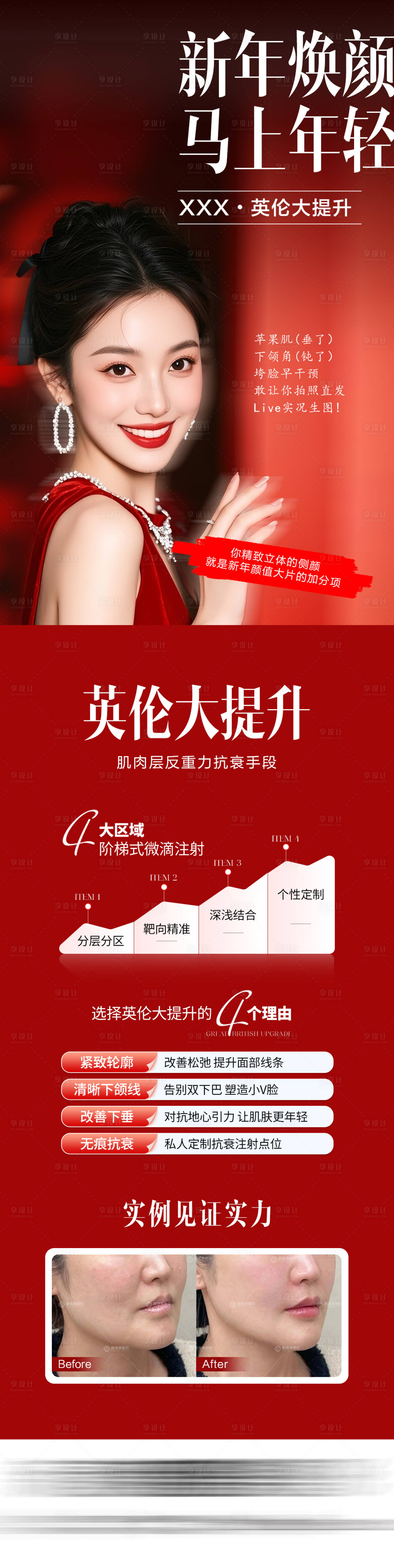 源文件下载【享设计】搜索编号：83320035405639539【医美新年英伦大提升海报】