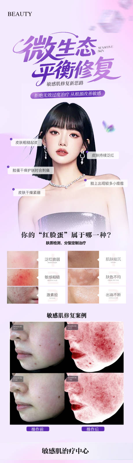 源文件下载【享设计】搜索编号：75080035574853123【医美敏感肌长图案例海报】