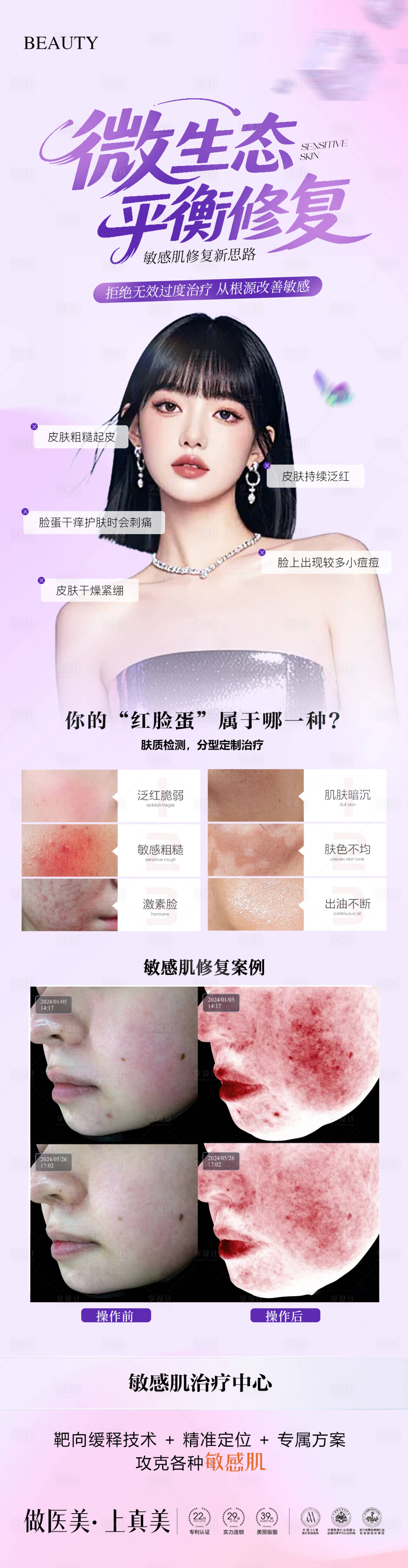 源文件下载【享设计】搜索编号：75080035574853123【医美敏感肌长图案例海报】