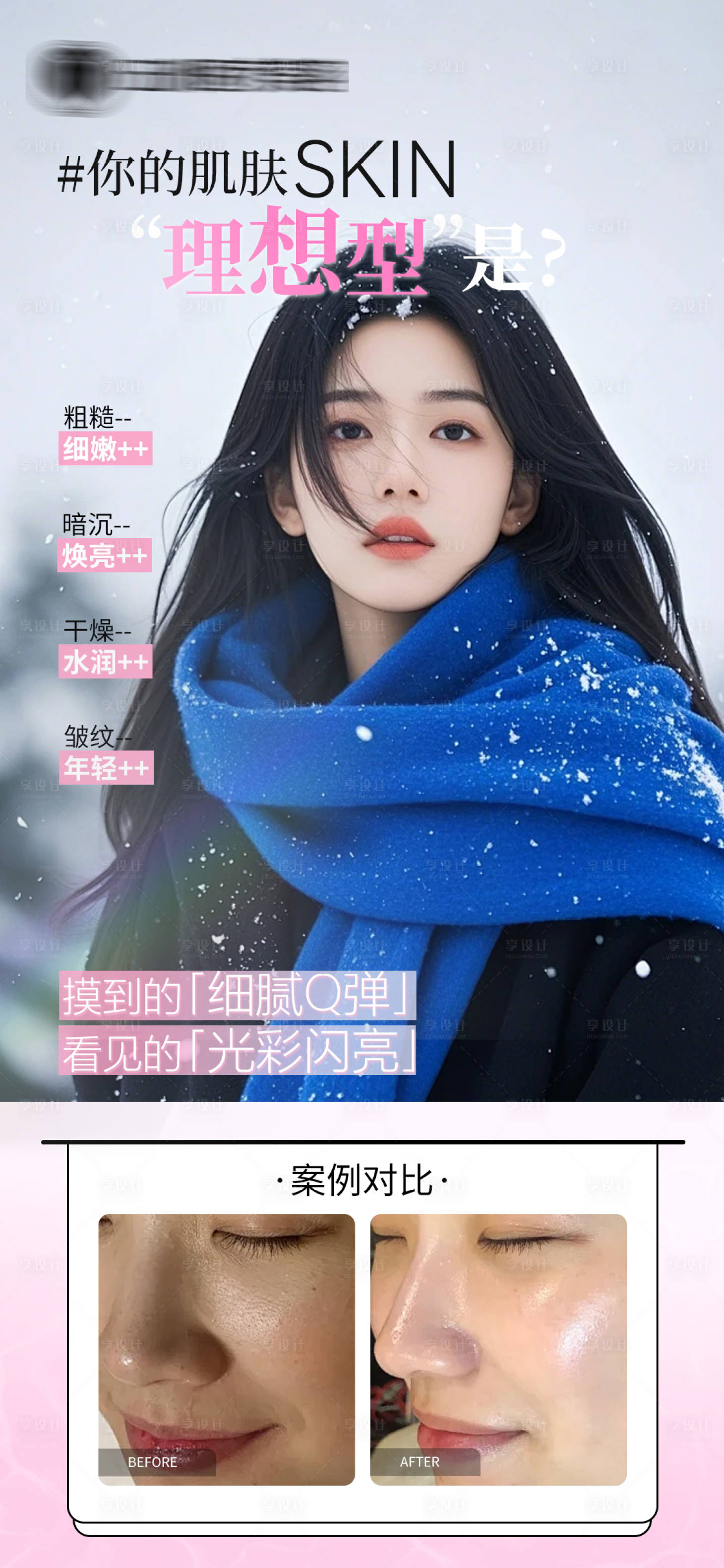 源文件下載【享設(shè)計(jì)】搜索編號(hào)：15070035371117078【醫(yī)美補(bǔ)水案例對(duì)比】