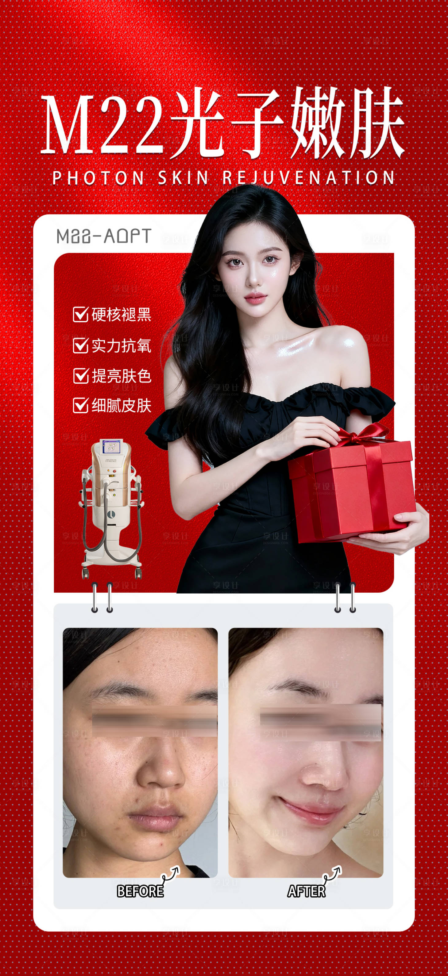 源文件下载【享设计】搜索编号：94790035412781005【m22光子嫩肤】