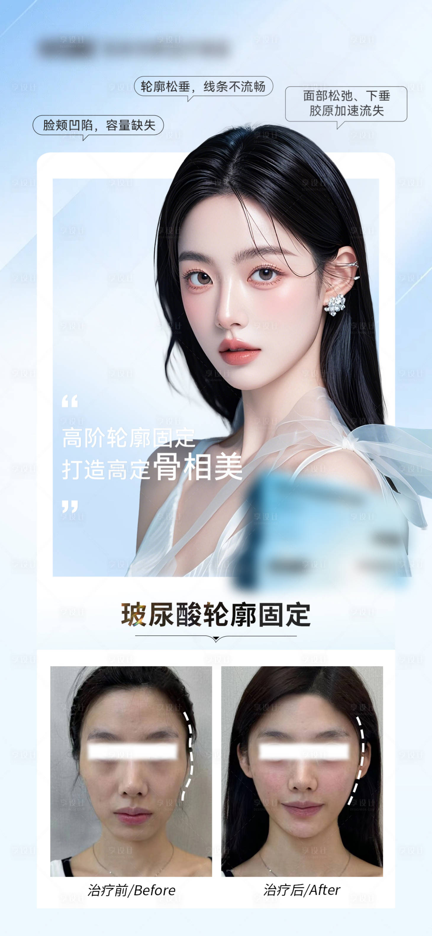 源文件下载【享设计】搜索编号：90980035418722229【医美轮廓固定海报】