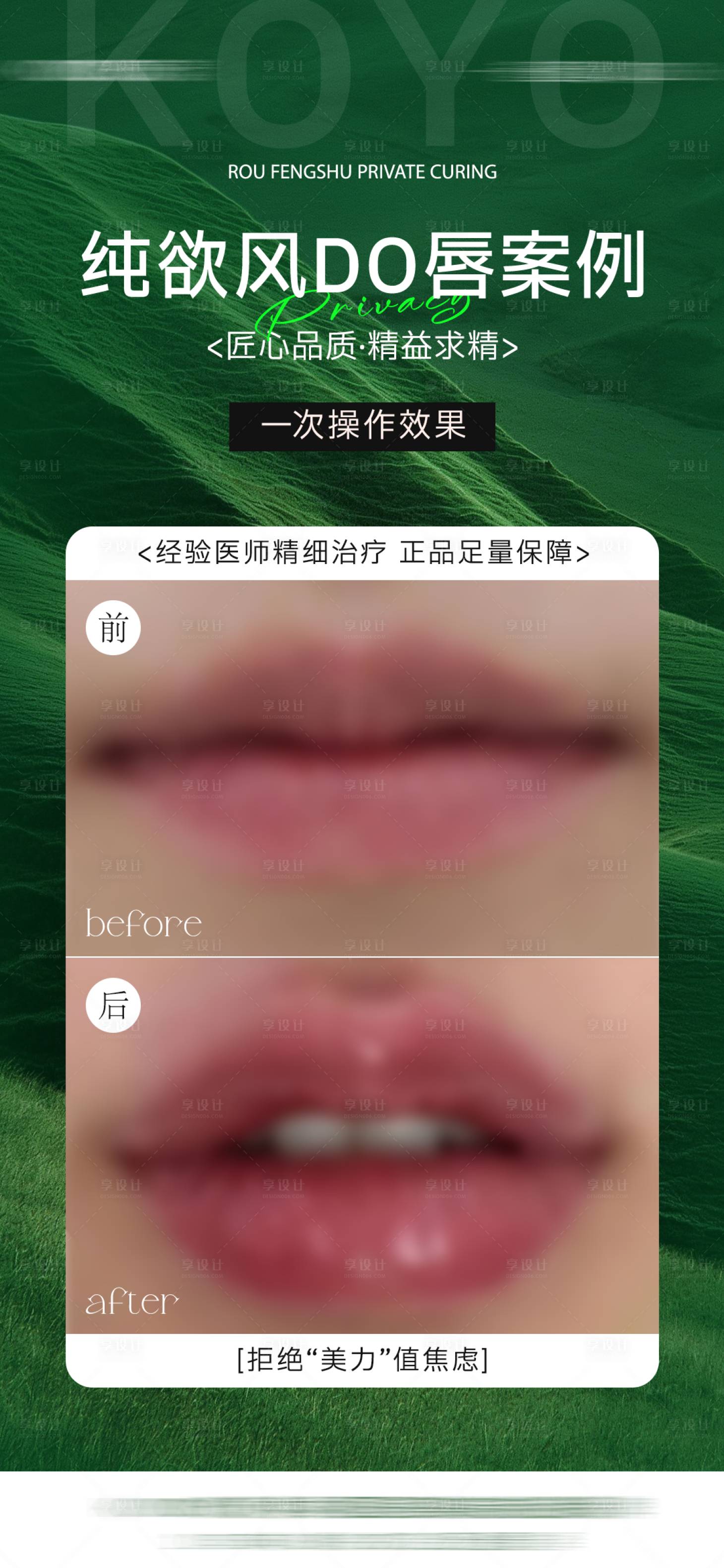 源文件下载【享设计】搜索编号：80880035326671458【医美案例对比海报模板】