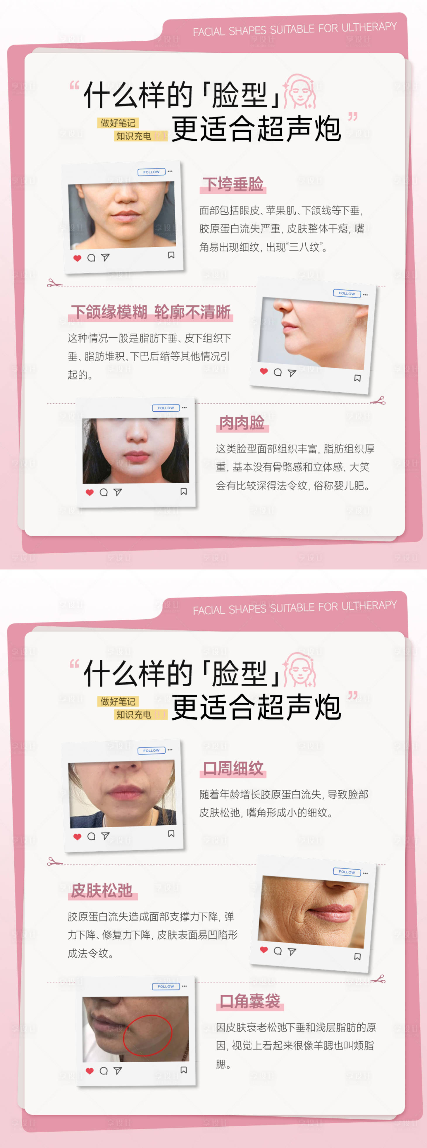 源文件下载【享设计】搜索编号：37500035384933972【医美小红书超声炮套图系列海报】