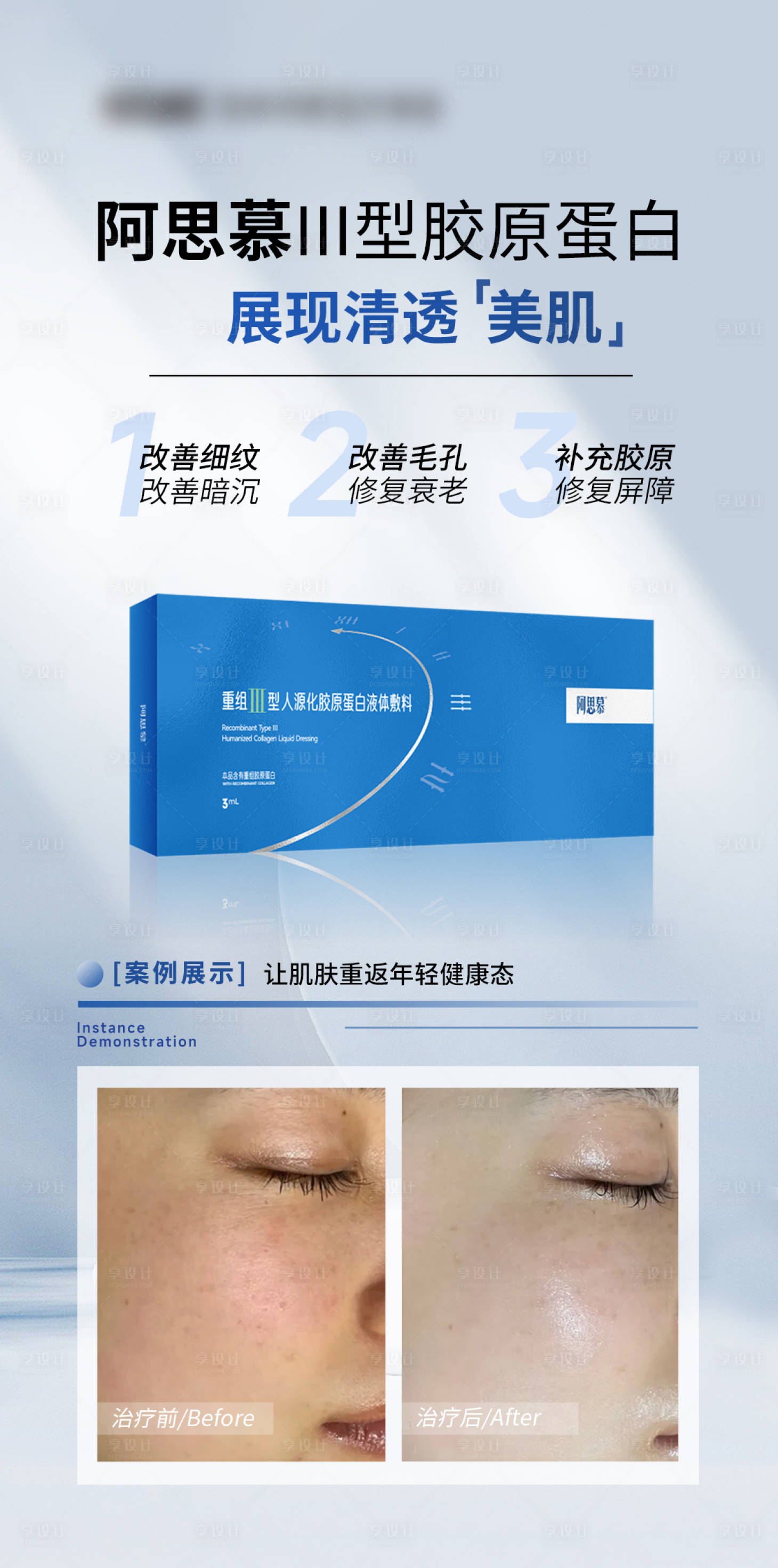 源文件下载【享设计】搜索编号：55290035418825552【医美水光产品海报】