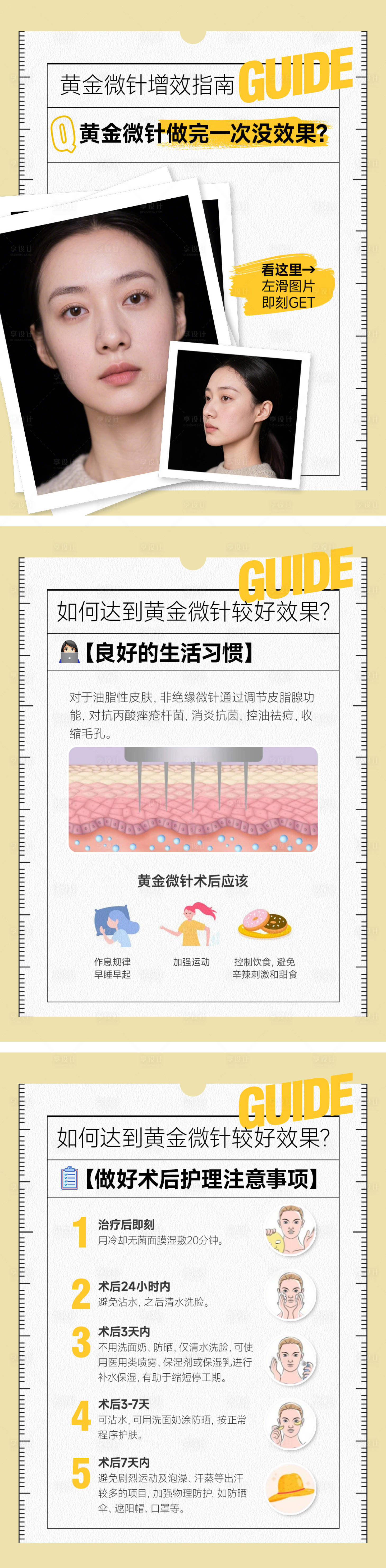 源文件下载【享设计】搜索编号：68190035343666651【医美小红书黄金微针套图系列海报】