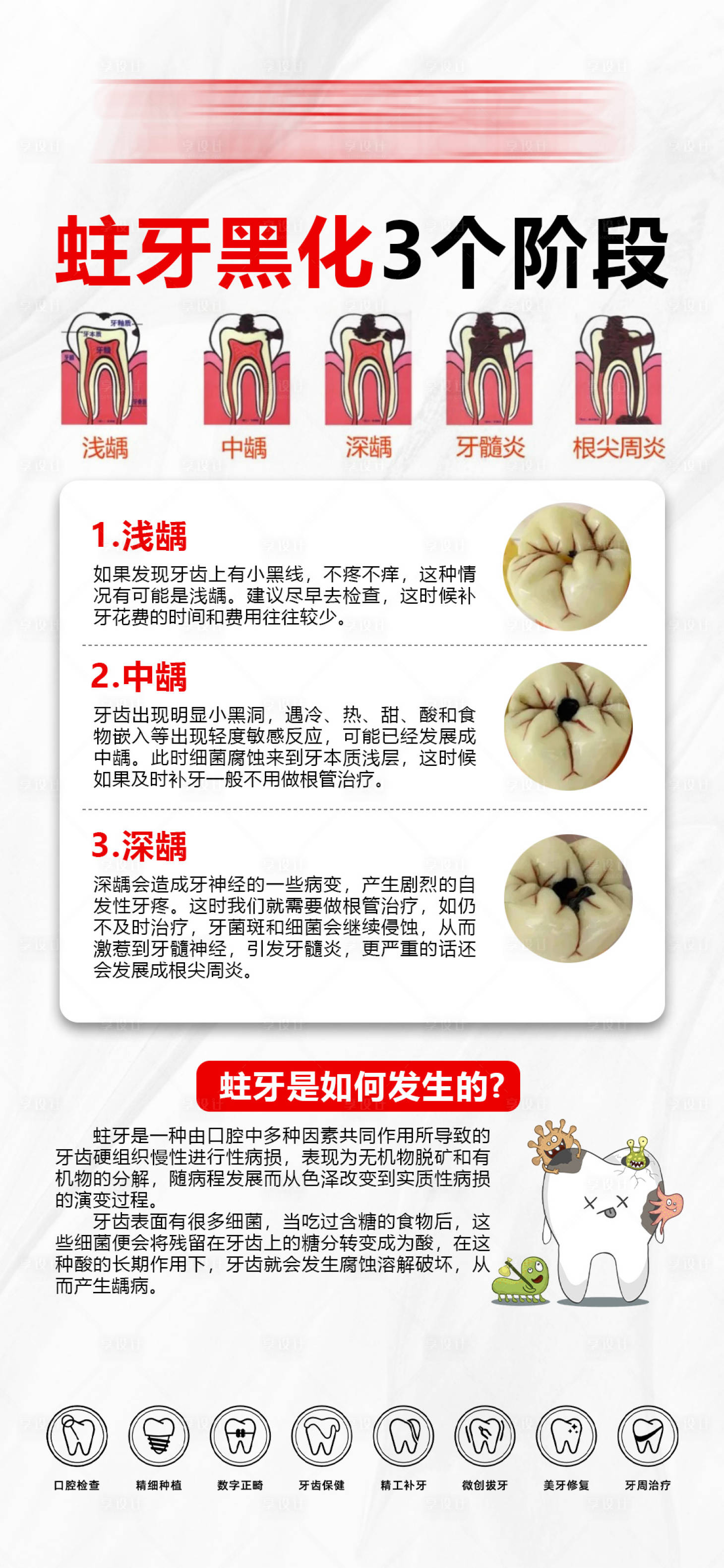 源文件下载【享设计】搜索编号：41650035346261286【蛀牙黑化3个阶段】