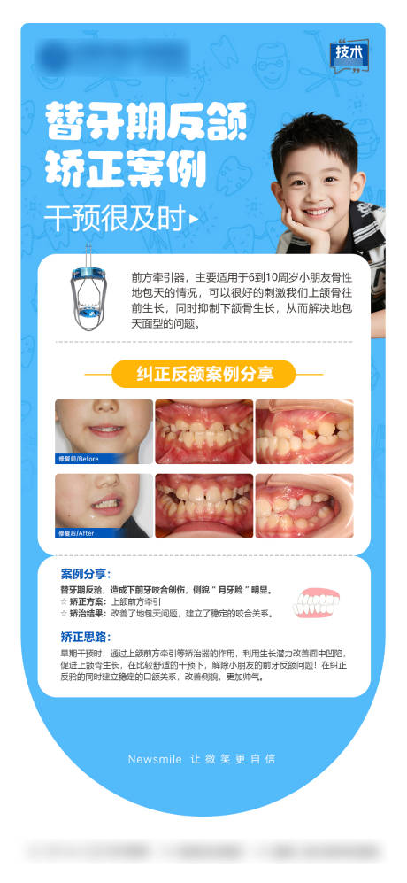 源文件下载【享设计】搜索编号：96240035444139119【儿童反颌矫正科普海报】