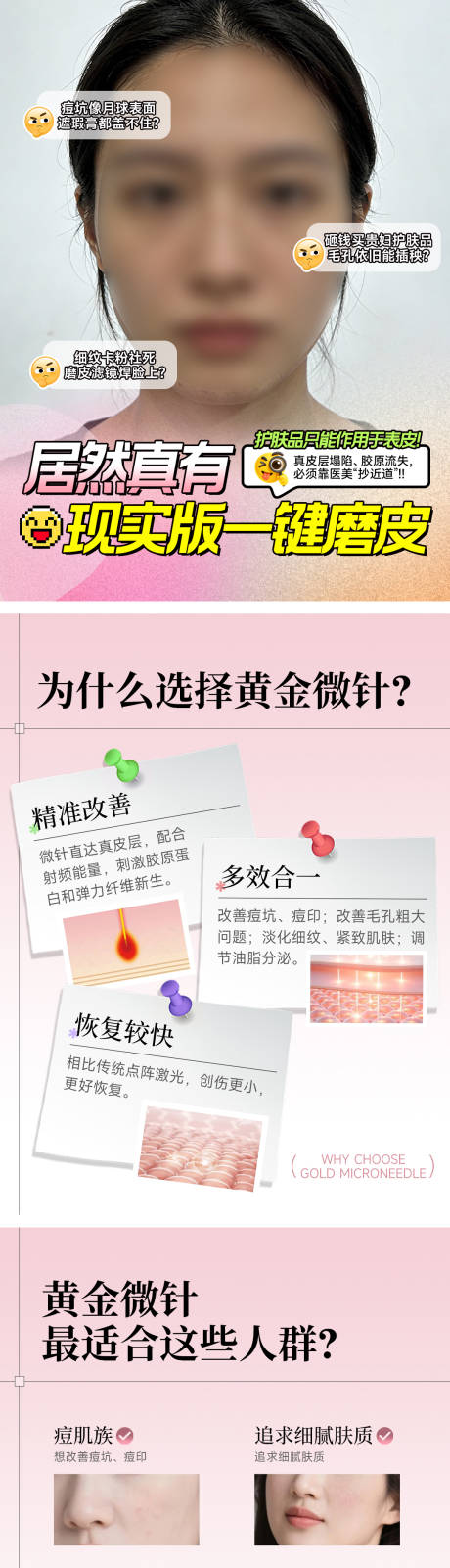 源文件下载【享设计】搜索编号：24030035422946749【医美小红书黄金微针套图】