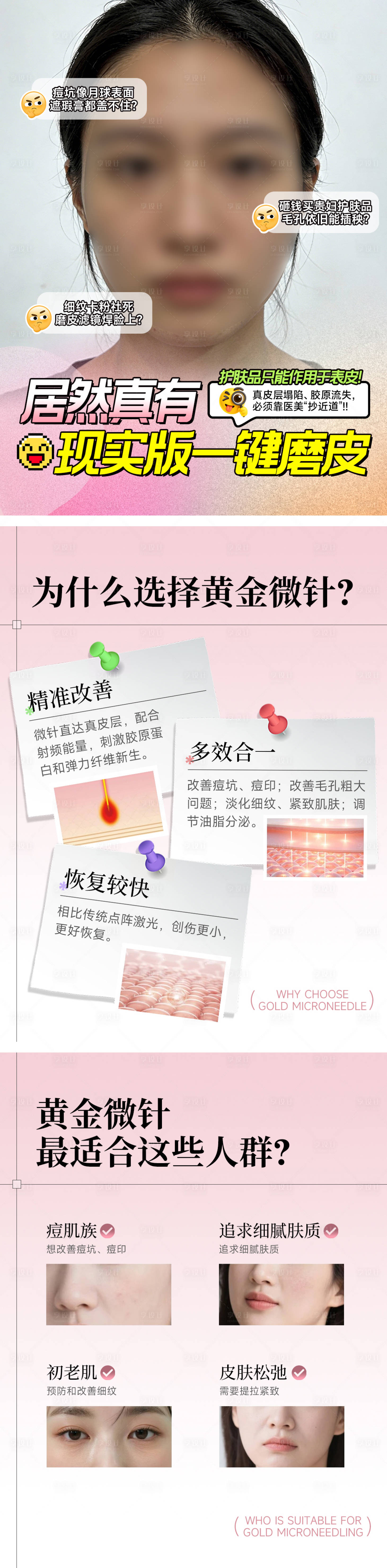 源文件下载【享设计】搜索编号：24030035422946749【医美小红书黄金微针套图】