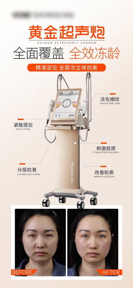 源文件下载【享设计】搜索编号：61090035419463371【医美黄金超声炮海报】