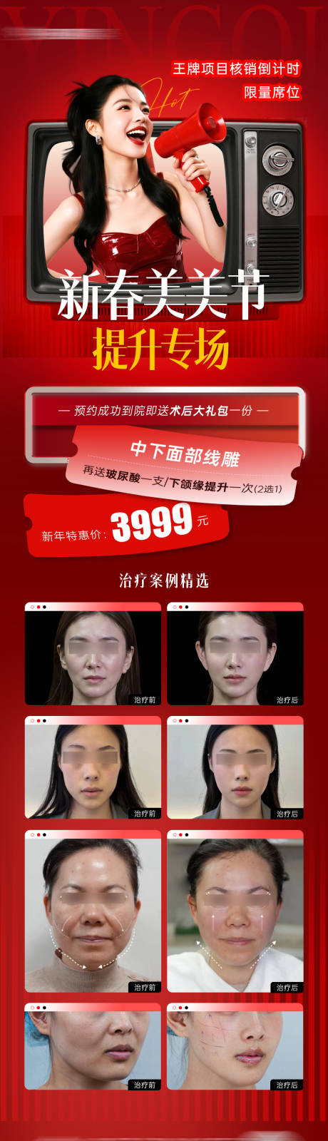 源文件下载【享设计】搜索编号：22320035509842198【医美抗衰活动长图】