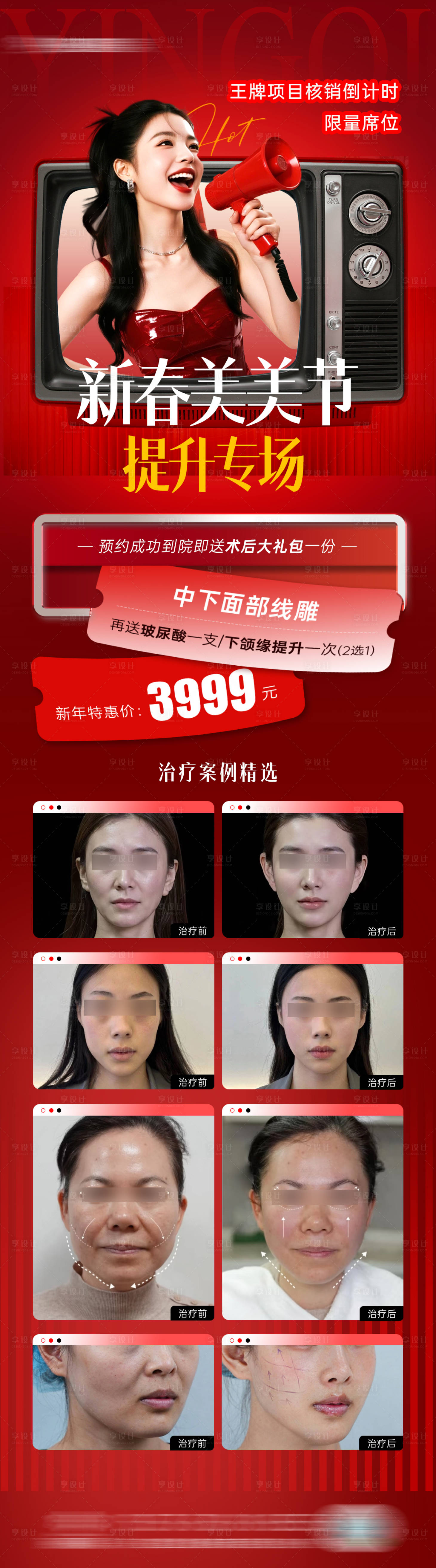 源文件下载【享设计】搜索编号：22320035509842198【医美抗衰活动长图】