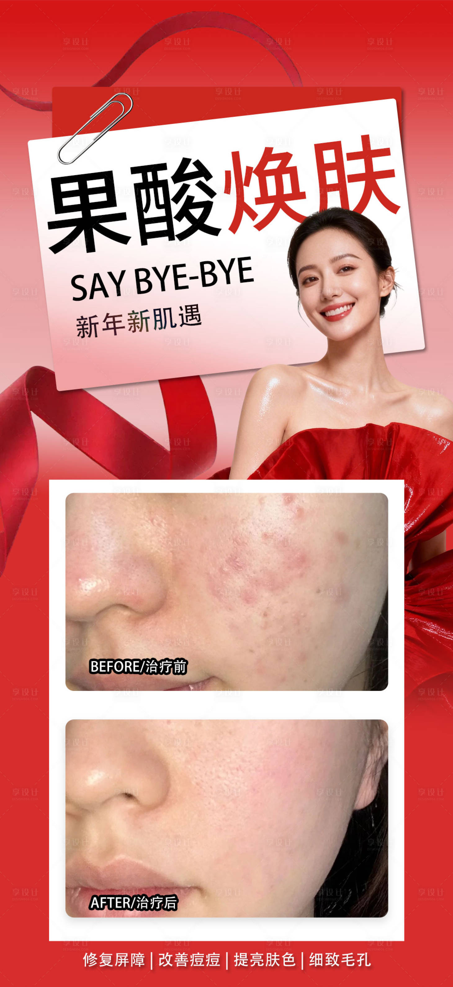 源文件下载【享设计】搜索编号：60380035412851184【果酸焕肤】