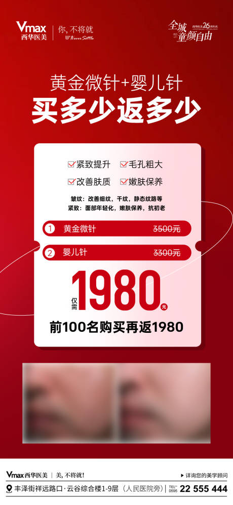 源文件下载【享设计】搜索编号：64110035525744295【医美黄金微针优惠海报】