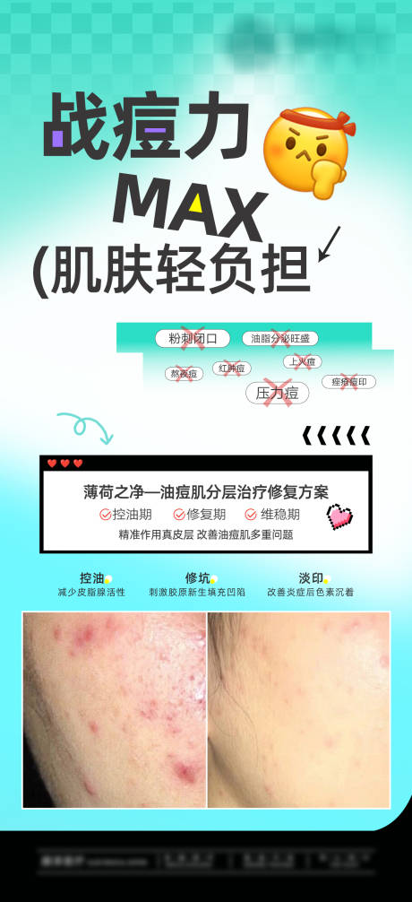 源文件下载【享设计】搜索编号：78680035578842249【痘痘肌肤 】
