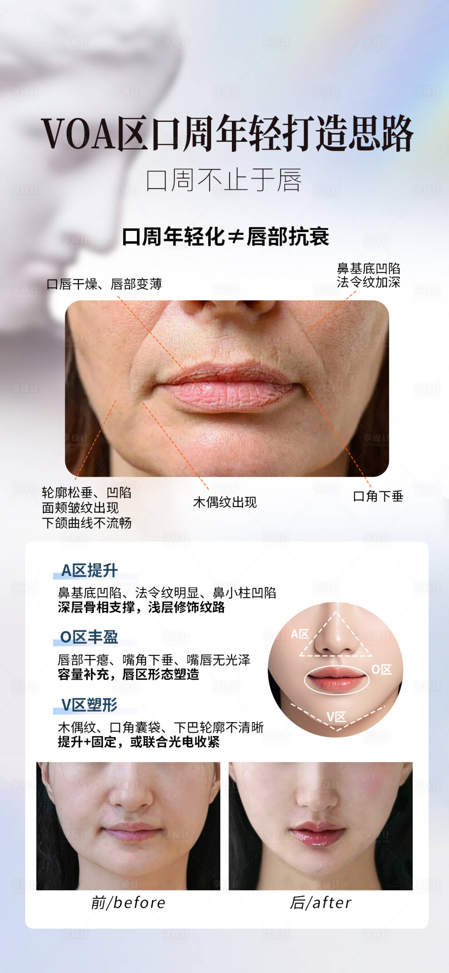 源文件下载【享设计】搜索编号：10810035316959070【口周抗衰思路】