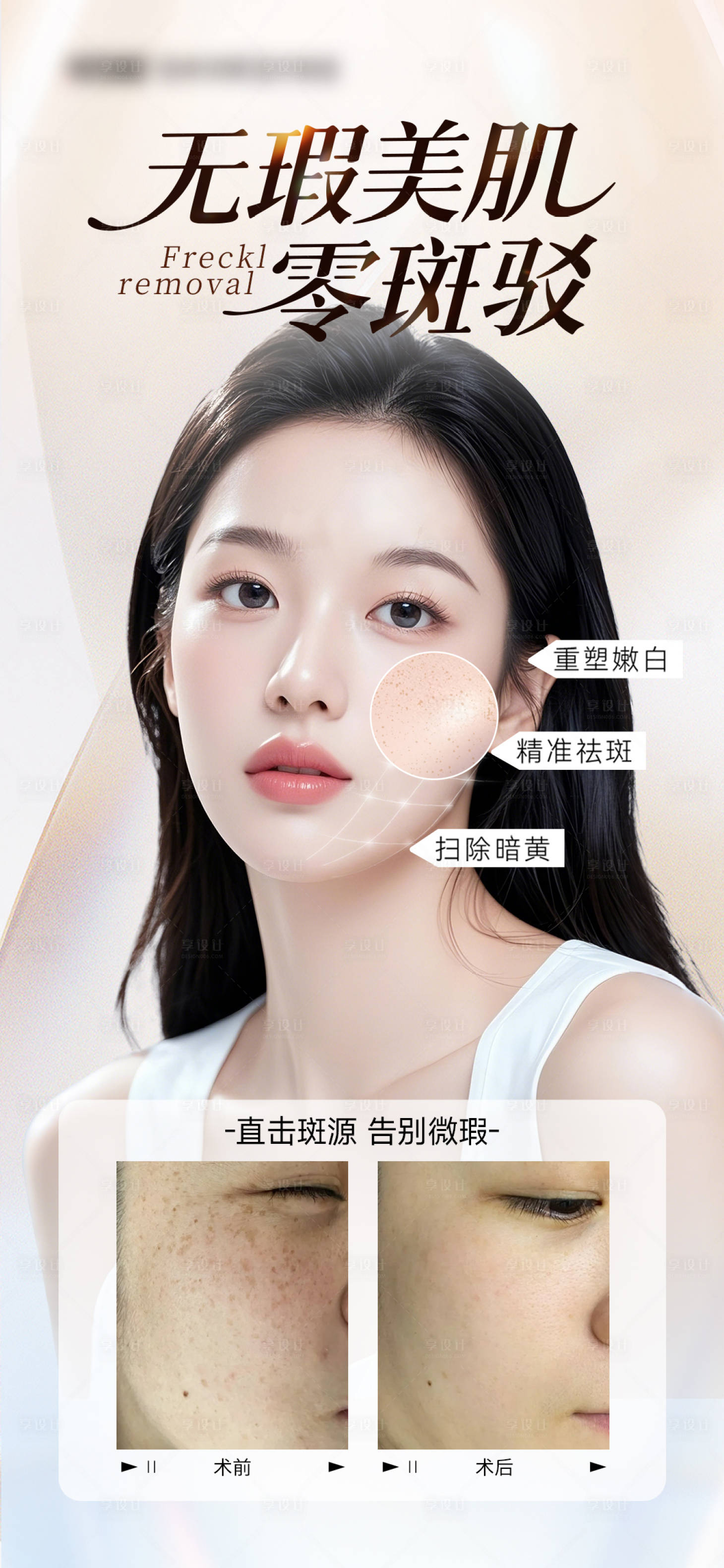 源文件下载【享设计】搜索编号：63630035420727226【医美祛斑海报】