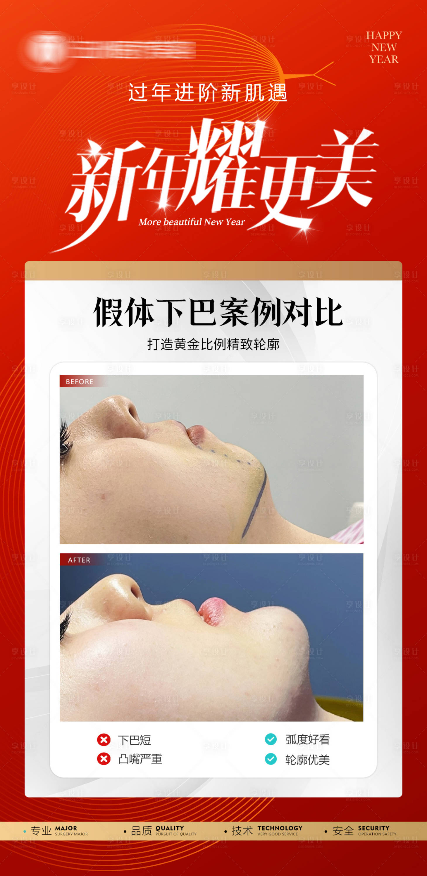 源文件下载【享设计】搜索编号：36370035499916958【医美案例对比】