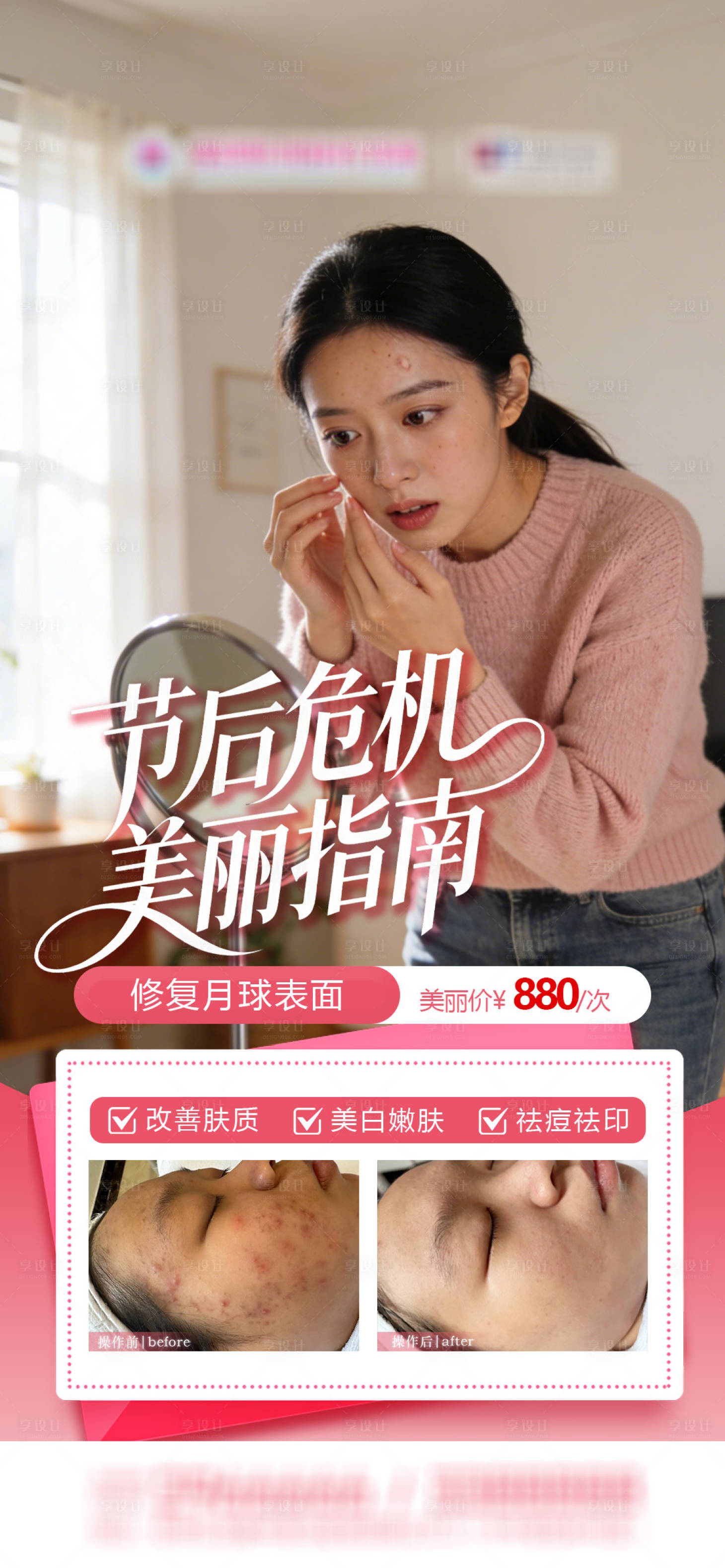 源文件下载【享设计】搜索编号：93910035467037415【节后危机美丽指南祛痘】