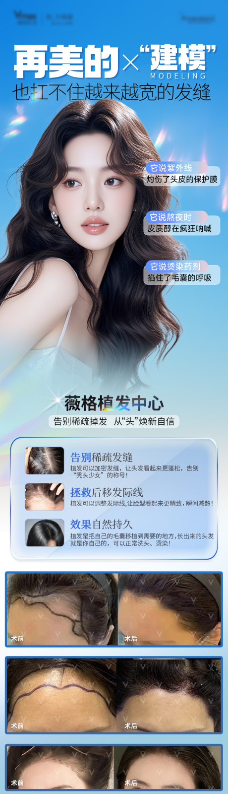 源文件下载【享设计】搜索编号：41620036005478121【植发发际线地中海生发创意案例海报】