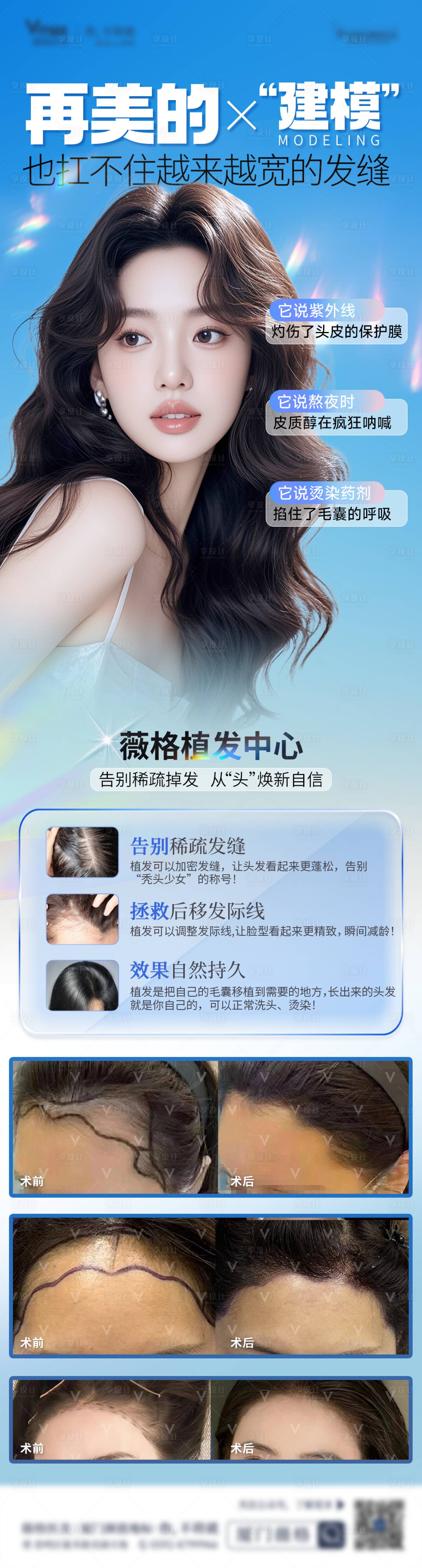 源文件下载【享设计】搜索编号：41620036005478121【植发发际线地中海生发创意案例海报】