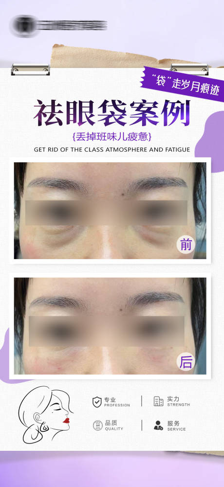 源文件下载【享设计】搜索编号：27160035976793268【医美案例对比（TIF用PS打开）】