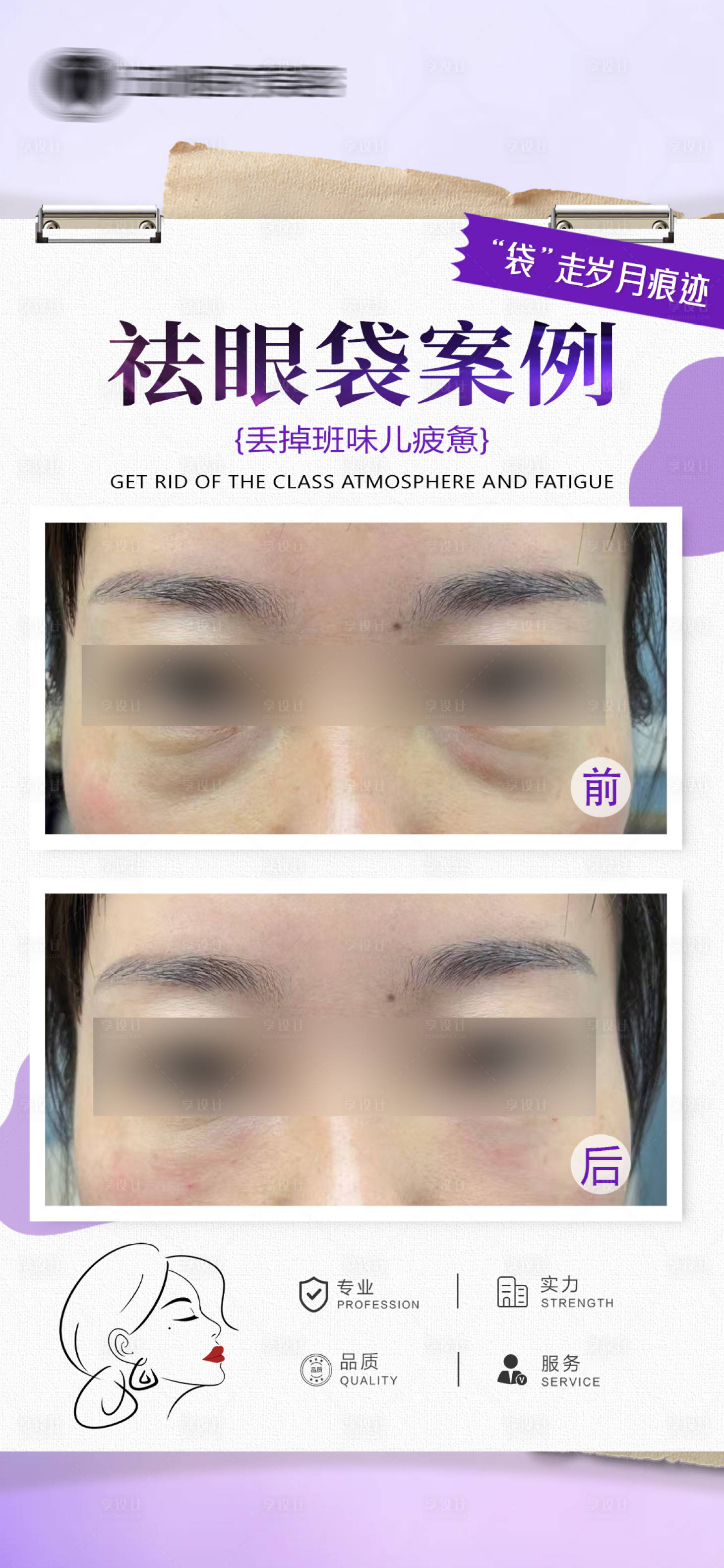 源文件下载【享设计】搜索编号：27160035976793268【医美案例对比】