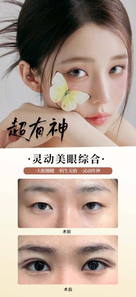 源文件下载【享设计】搜索编号：86340035659943937【医美双眼皮案例海报】