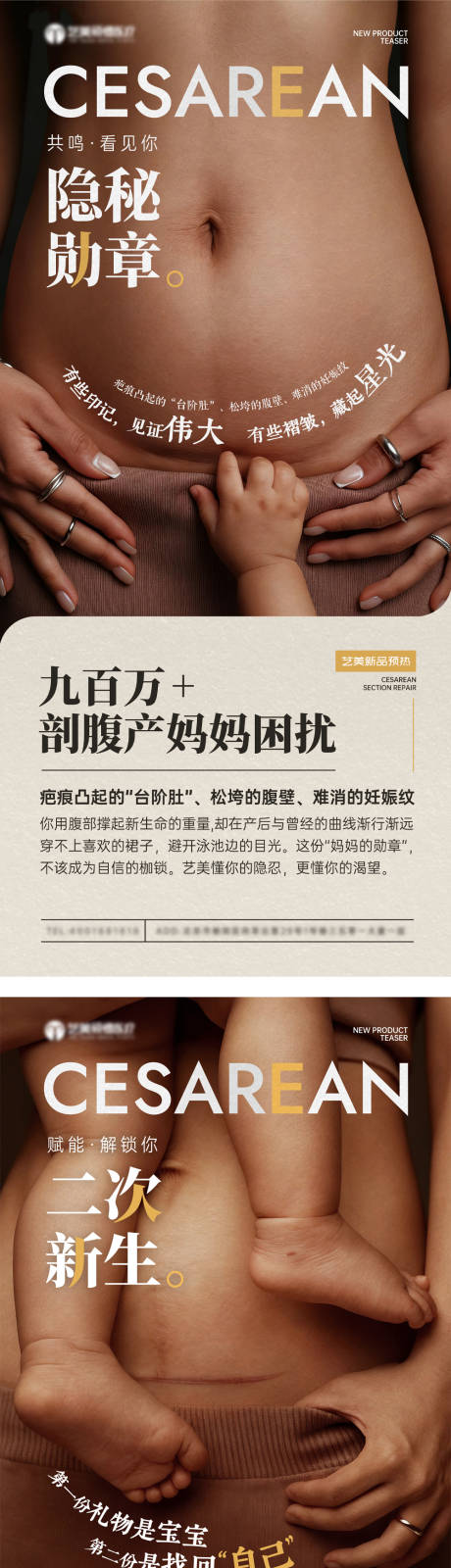 源文件下载【享设计】搜索编号：55260035812489810【刨妇产疤痕去除医美海报】
