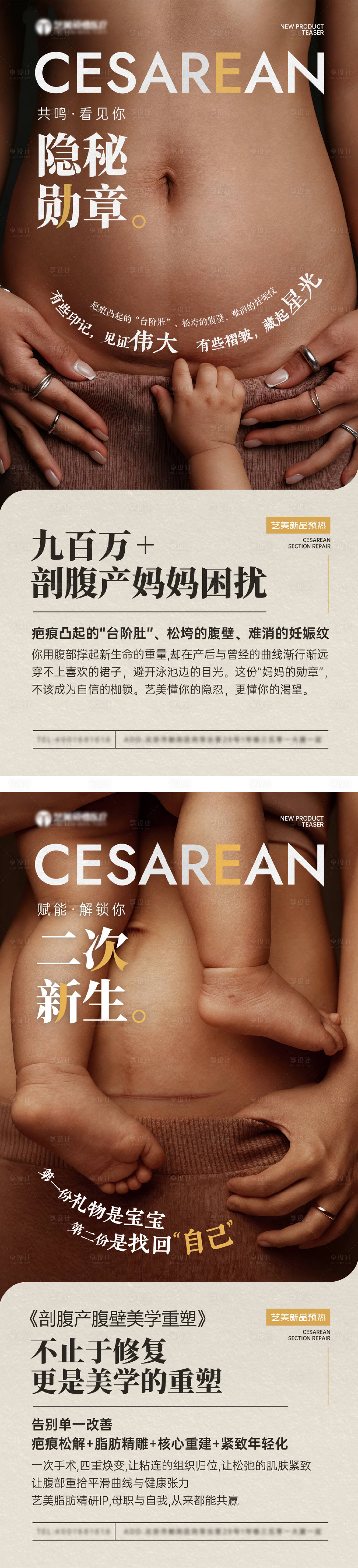 源文件下载【享设计】搜索编号：55260035812489810【刨妇产疤痕去除医美海报】