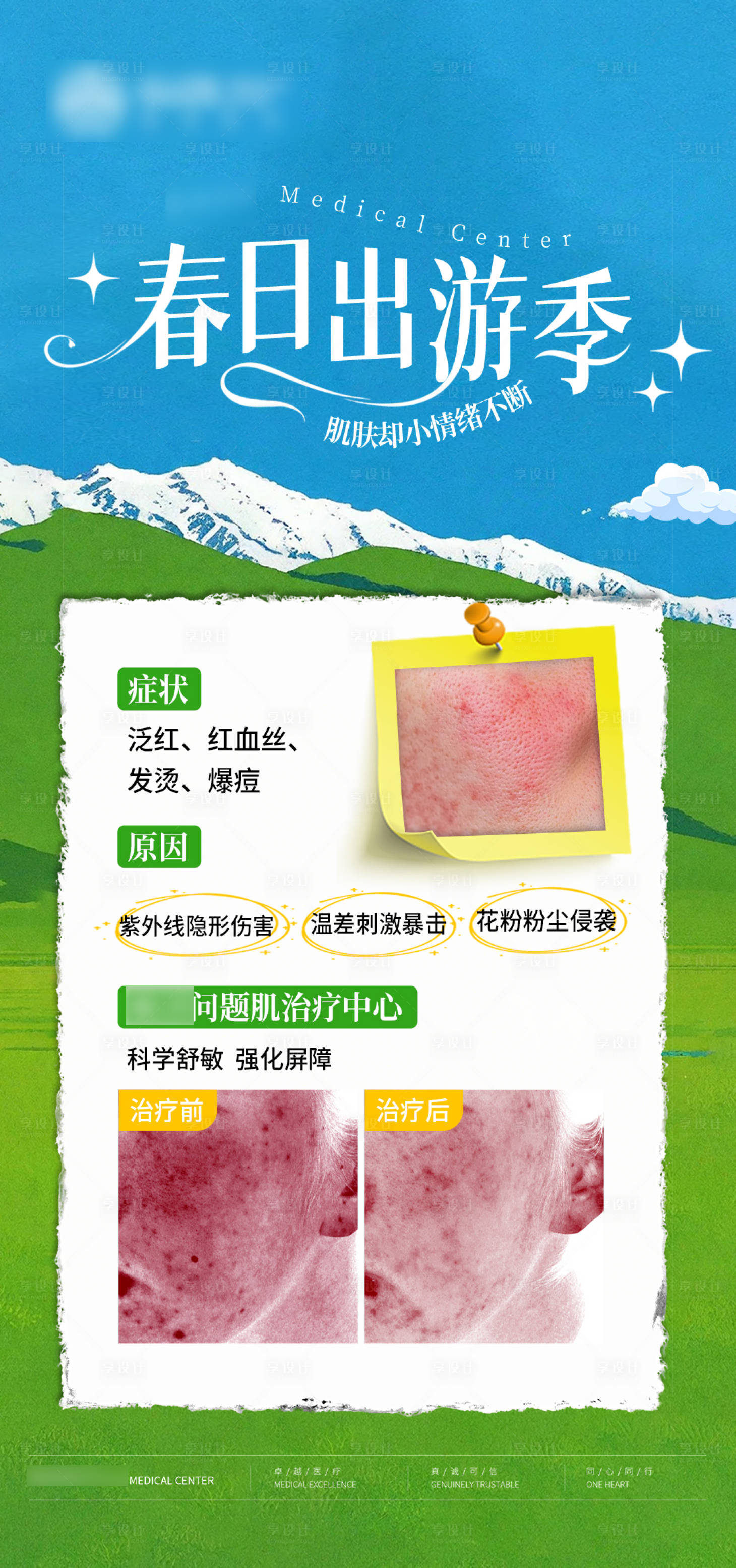 源文件下载【享设计】搜索编号：23020036070435909【医美皮肤海报】