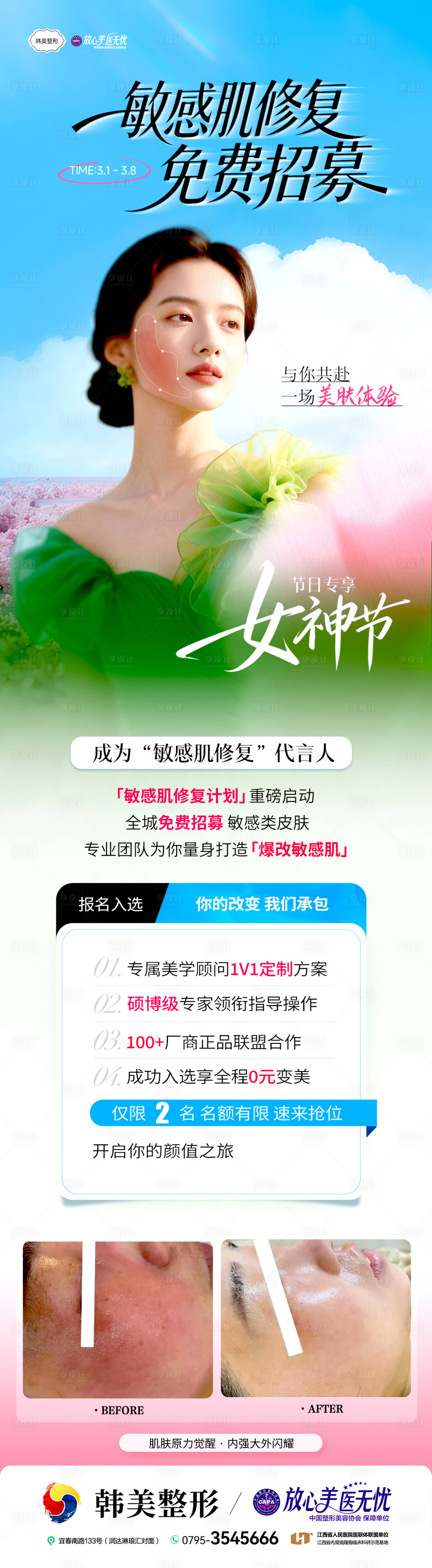 源文件下载【享设计】搜索编号：51340035788563667【敏感肌修复模特招募皮肤活动海报】