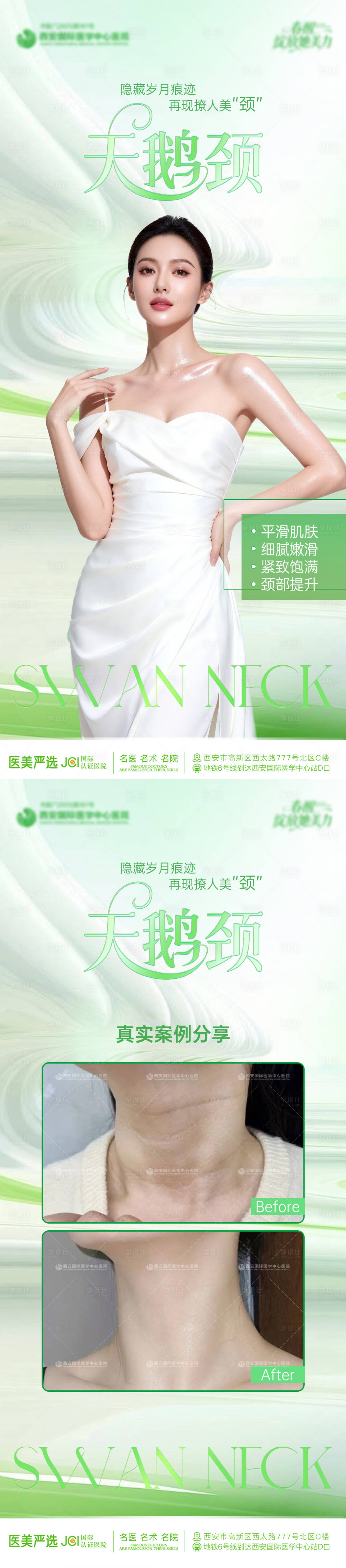 源文件下载【享设计】搜索编号：55640036152558977【天鹅颈医美案例海报】