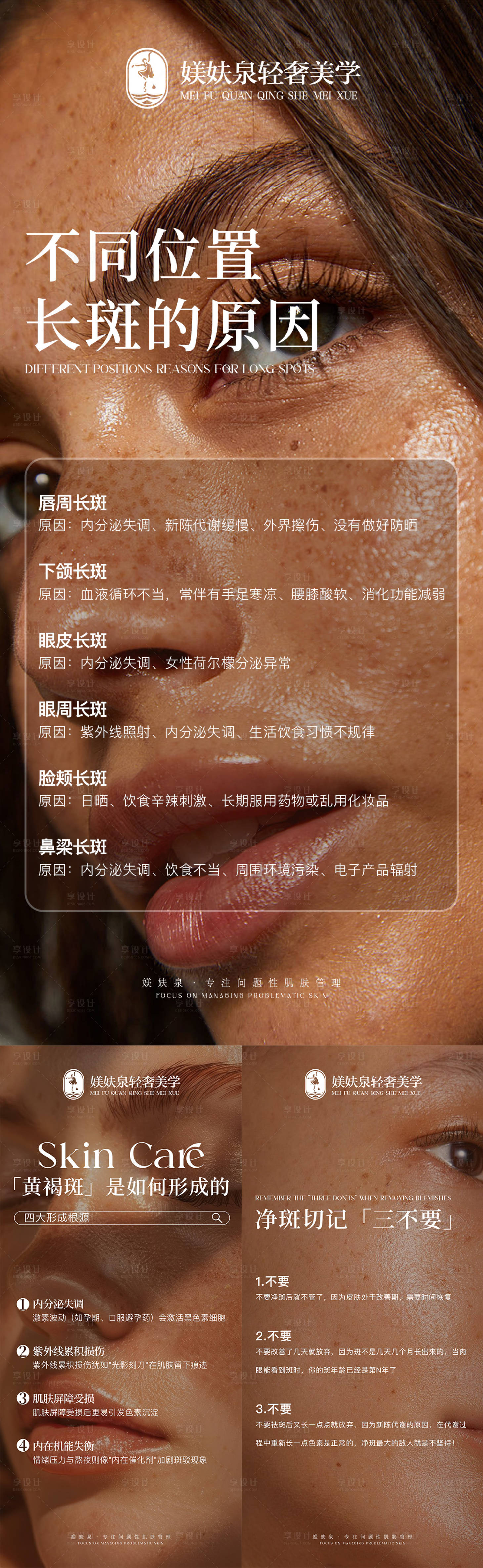 源文件下载【享设计】搜索编号：35900035821449865【祛斑科普】